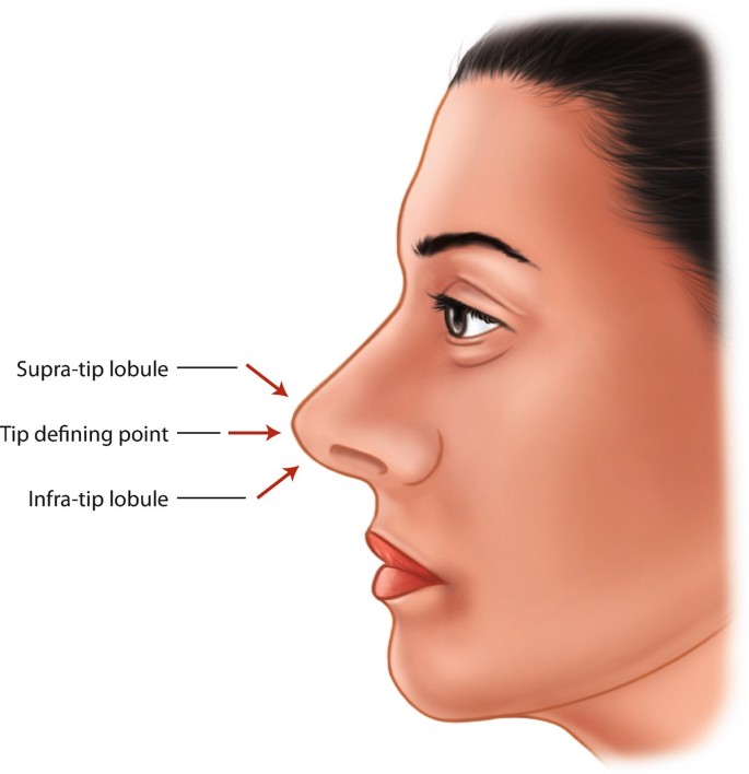 Surgical Anatomy of the Nasal Tip | SpringerLink