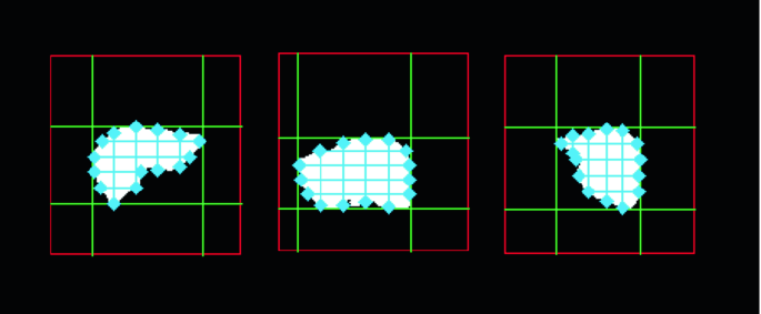 A Hashing Algorithm of Depth Image Matching for Liver Surgery | SpringerLink A Hashing Algorithm of Depth Image Matching for Liver Surgery | SpringerLink