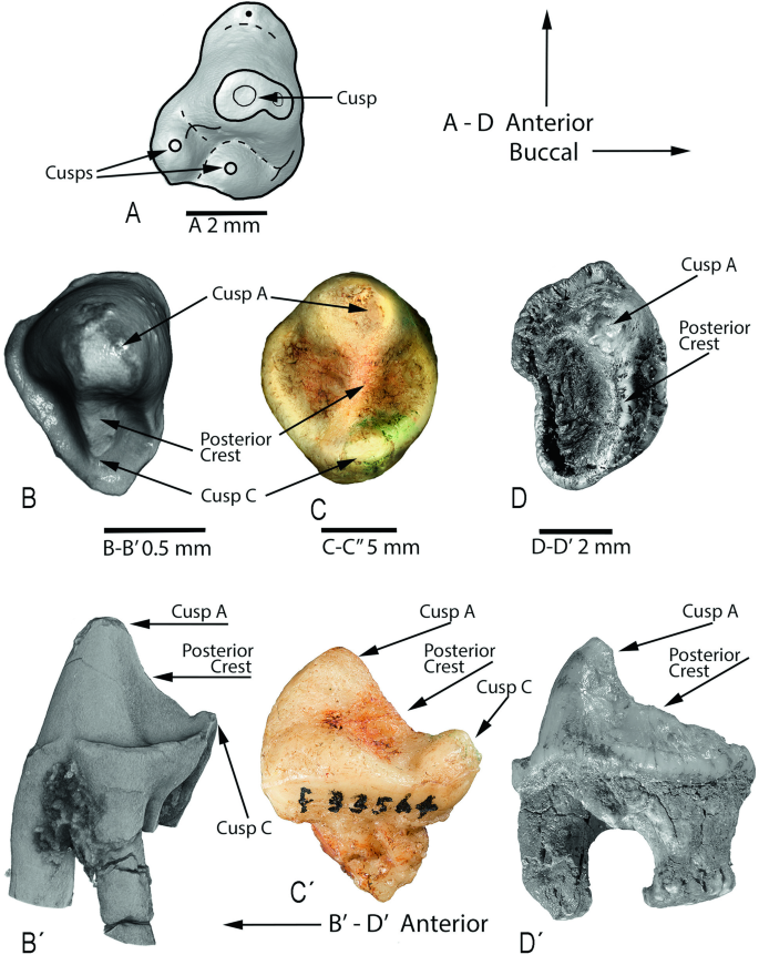 Prognathous, callipygous, steatopygous, exophthalmos