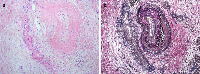 figure 35