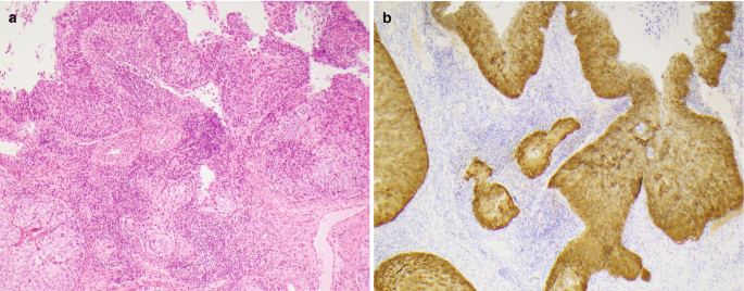 figure 33