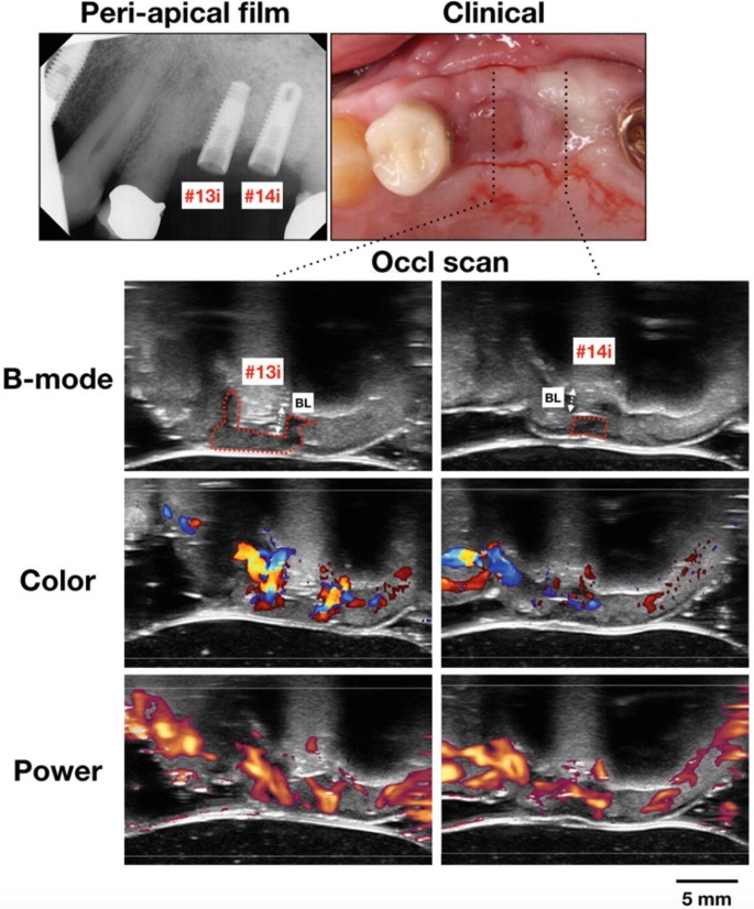 figure 11