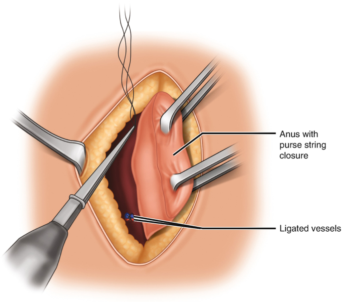 The Purse: History, Origin & FAQs – MAHI Leather