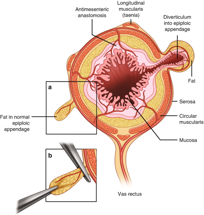 Colon and Anorectum | SpringerLink