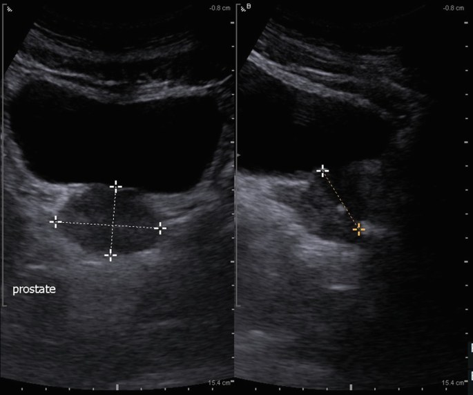 figure 42