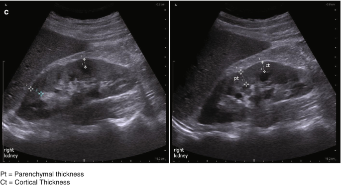 figure 45