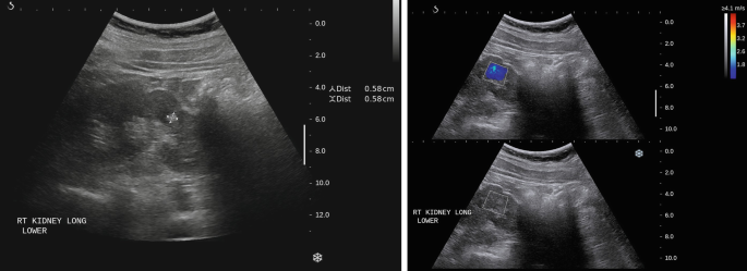 figure 48