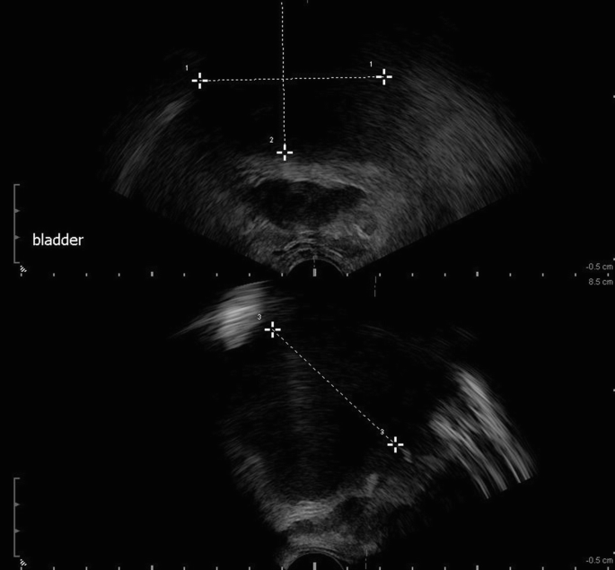 figure 57