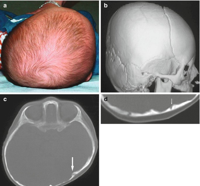 figure 41