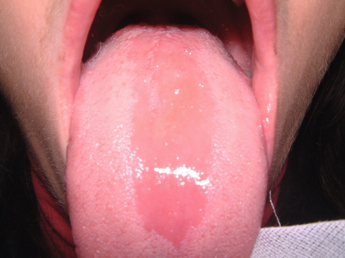 The Lips, Mouth, Tongue and Teeth: Part I | Springer Nature Link ...