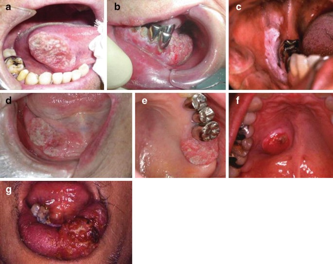 figure 37