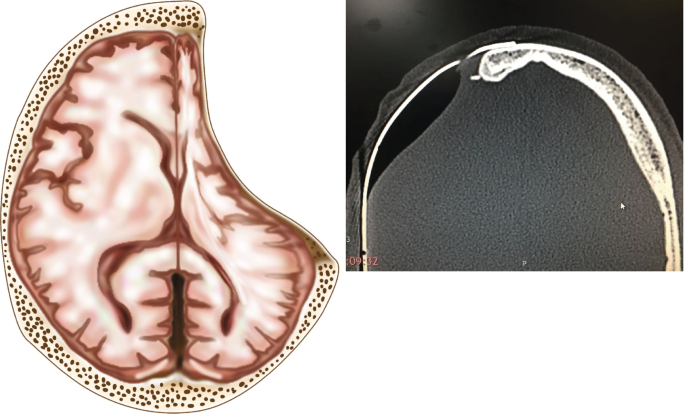 figure 26