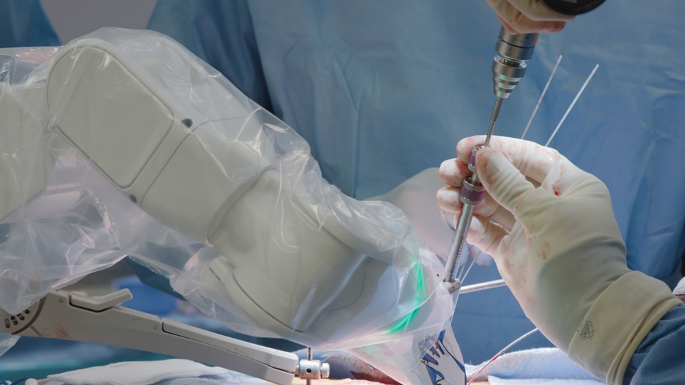 Mazor X Robotic Spine Surgery: Comparison of Robot-Assisted Surgeries