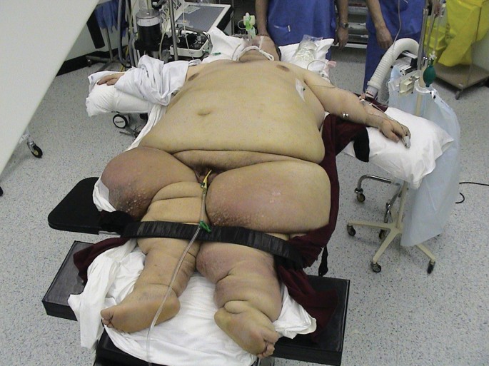 tirzepatide weight loss injections near me Compounded Tirzepatide Online for Diabetes & Weight Loss