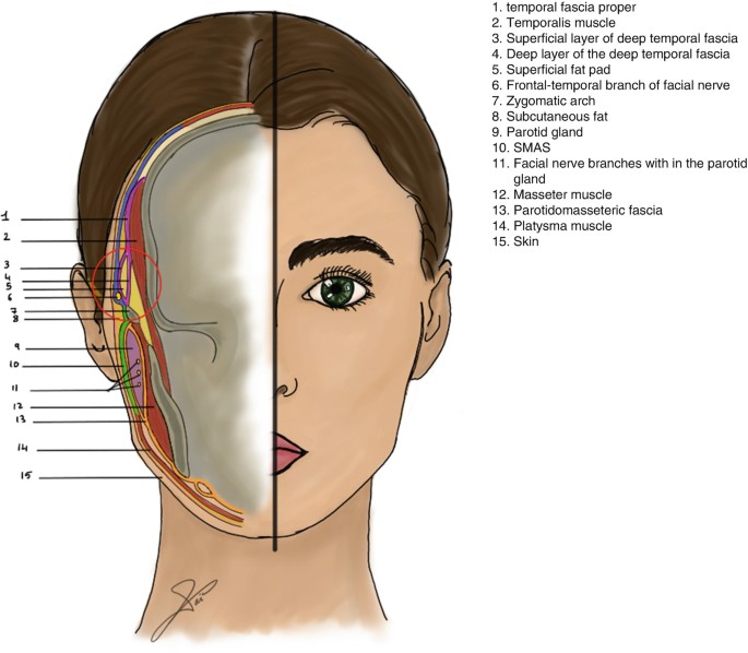 Layer-by-layer depiction of the masseter muscle showing the superficial
