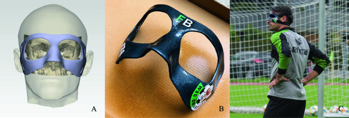 3D Printed Protective Face Mask For Athletes - BioTrib