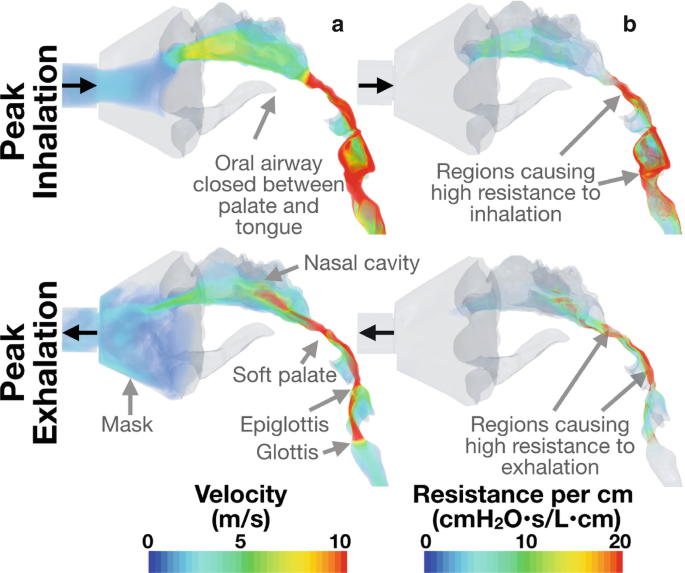 Non-Bronchoscopic Assessment of the Airways | SpringerLink