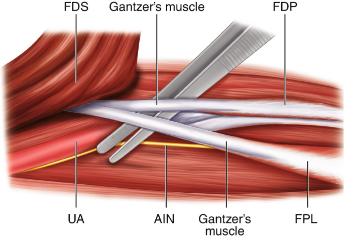 figure 19