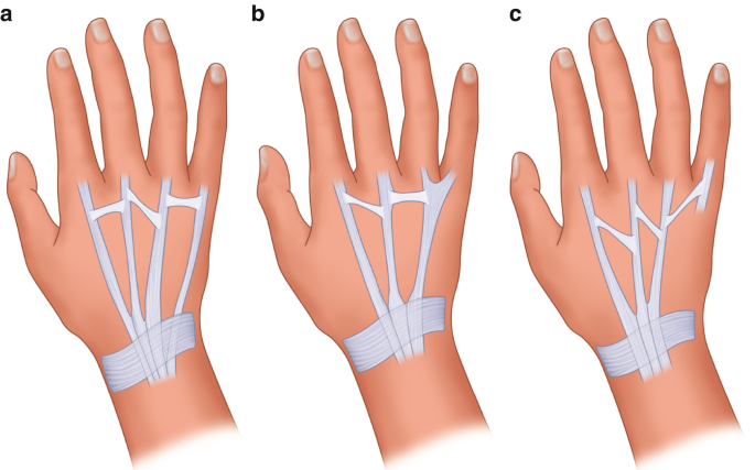 figure 23