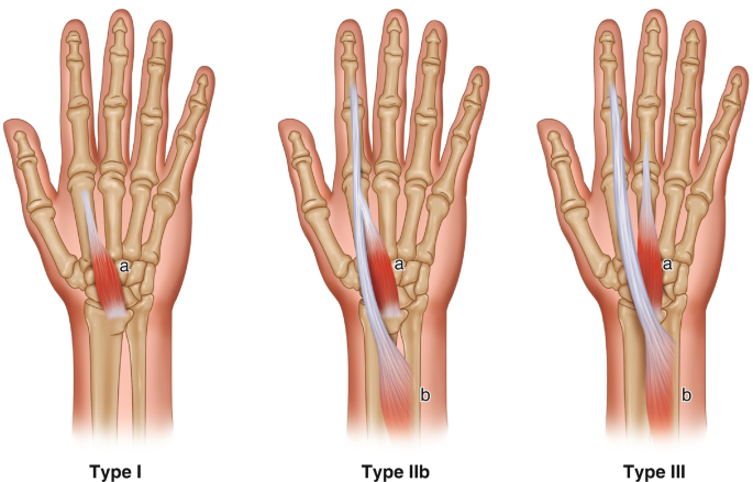 figure 27