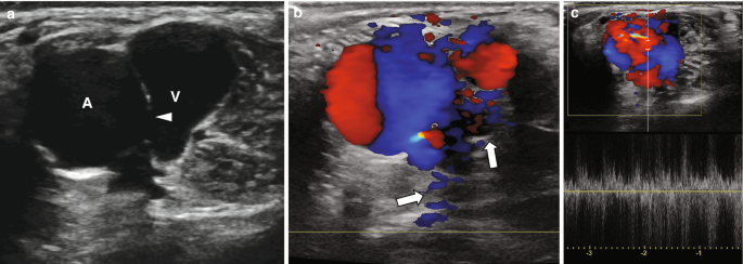 figure 25