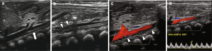 figure 38