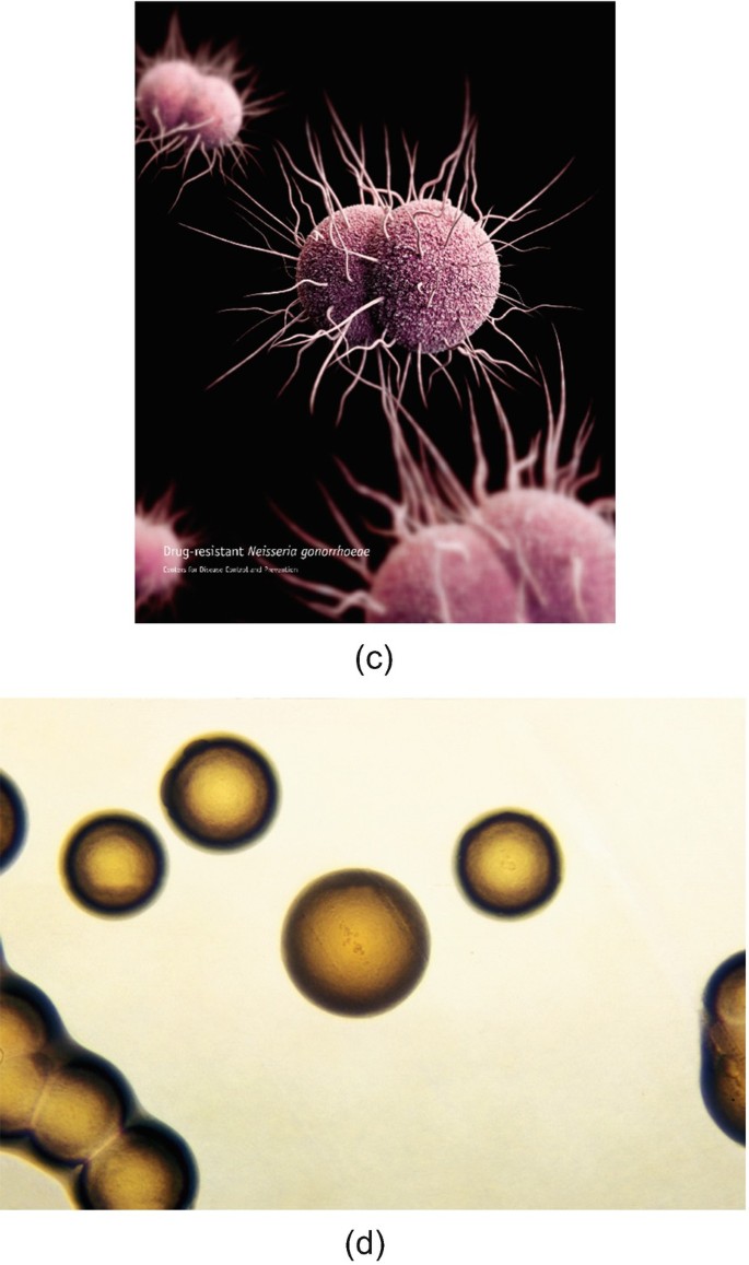Super-gonorrhoea has spread across England, doctors warn | The Week, image size:685x1157