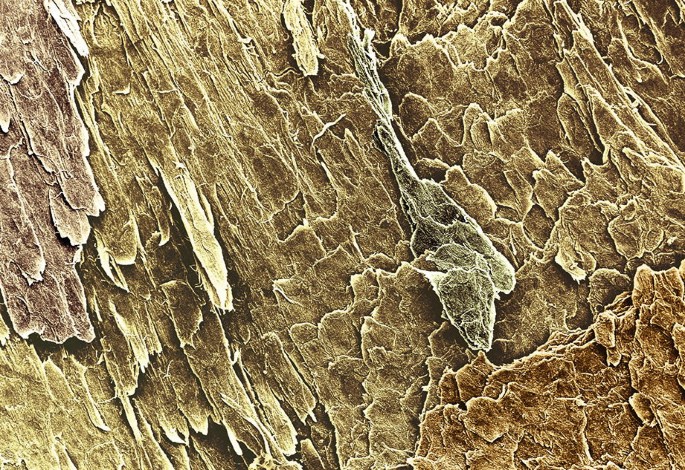 Light micrograph shows nail plate cells on an adhesive tape, following... |  Download Scientific Diagram