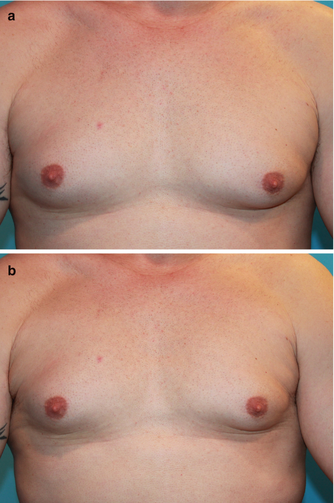adolescent nipples straddle 