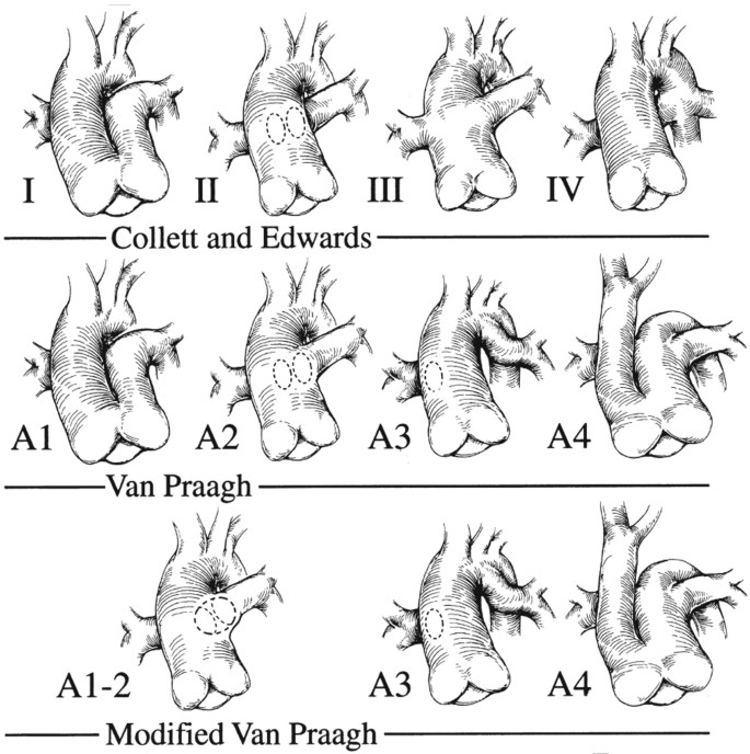 figure 31