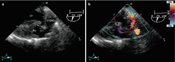 figure 36