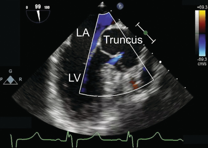 figure 38