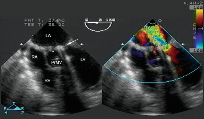 figure 16