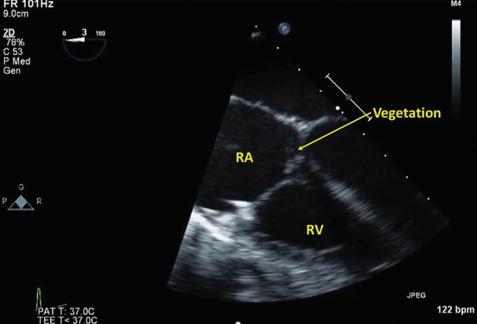 figure 24