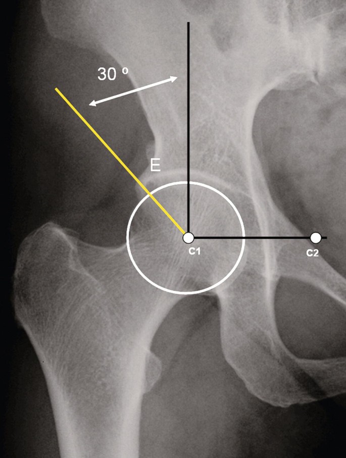 Normal Pelvis and Hip | Springer Nature Link