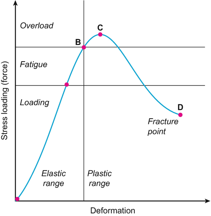 Stress Injury | SpringerLink