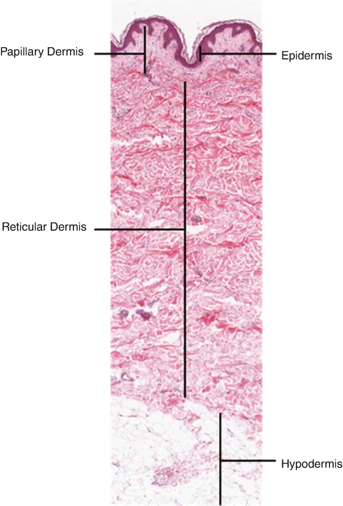 Solved The Dermis Extends Upward Between Ridges of