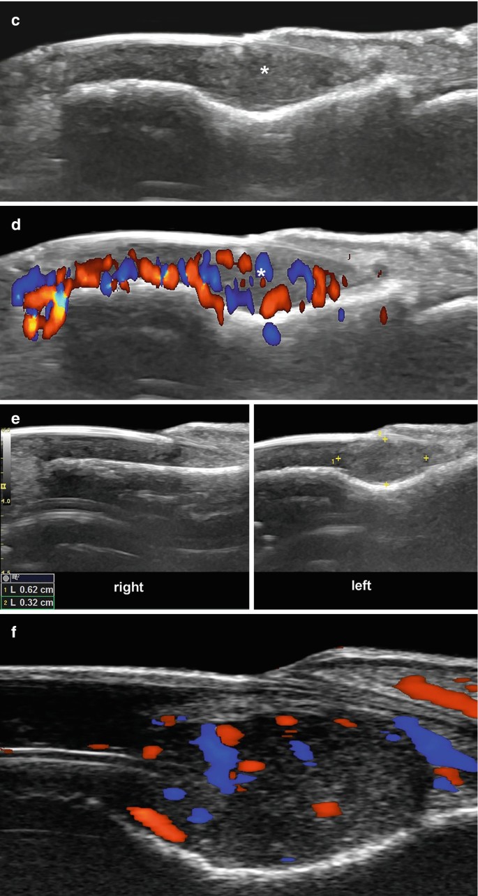 figure 17