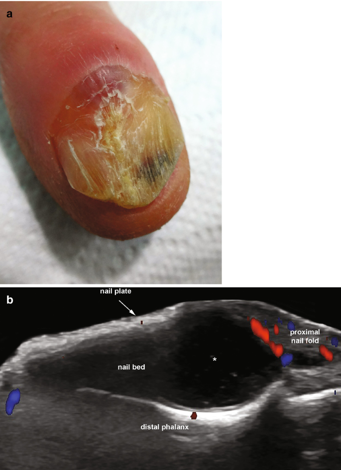 figure 22