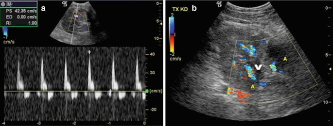 figure 17