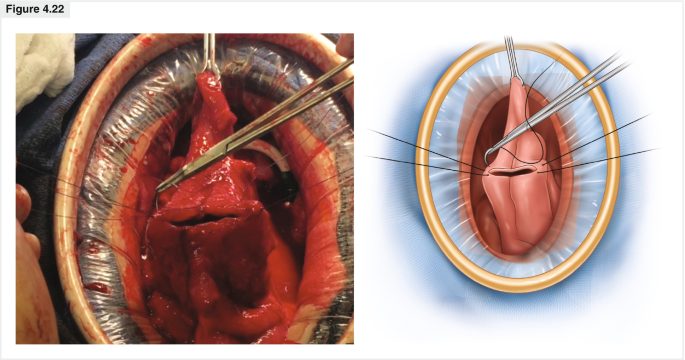 figure 22