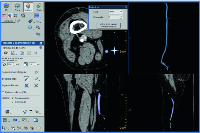 Volume Rendering Technique from DICOM® Data Applied to the Study