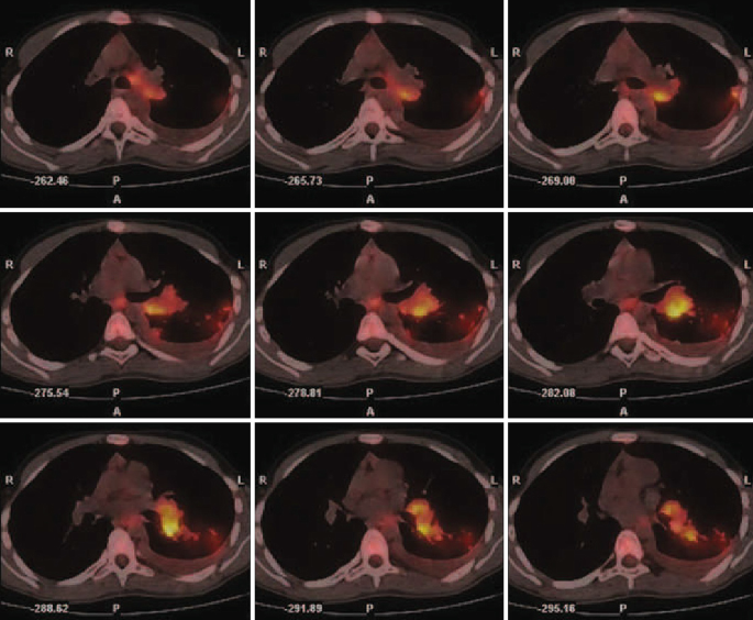 figure 15