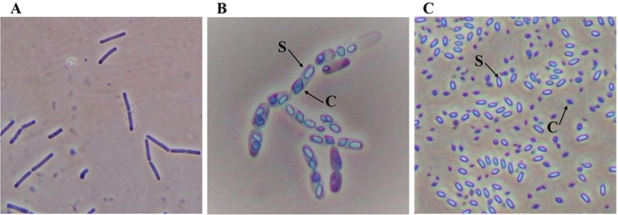 Sporulation in Bacillus thuringiensis Berliner. a The standard stages