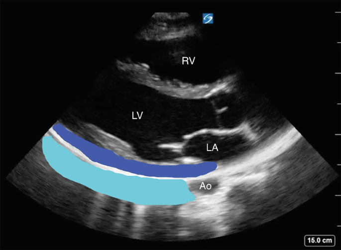 figure 27