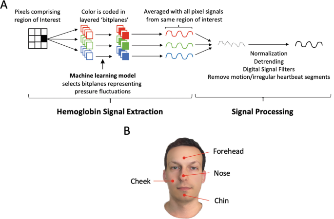 https://media.springernature.com/lw685/springer-static/image/chp%3A10.1007%2F978-3-030-64573-1_250/MediaObjects/497286_1_En_250_Fig2_HTML.png