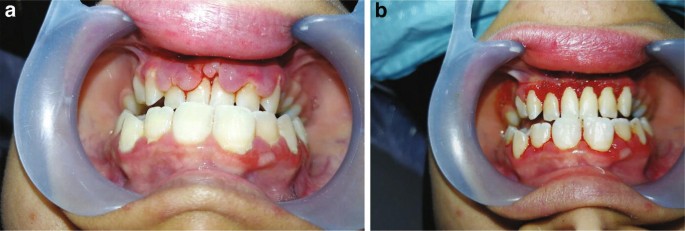 figure 14