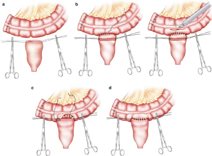 figure 39