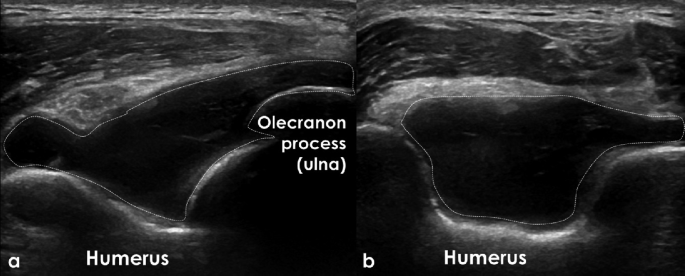 figure 36