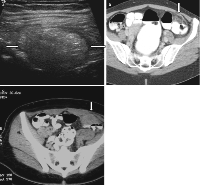 Pelvic Pain: Role of Imaging in the Diagnosis and Management
